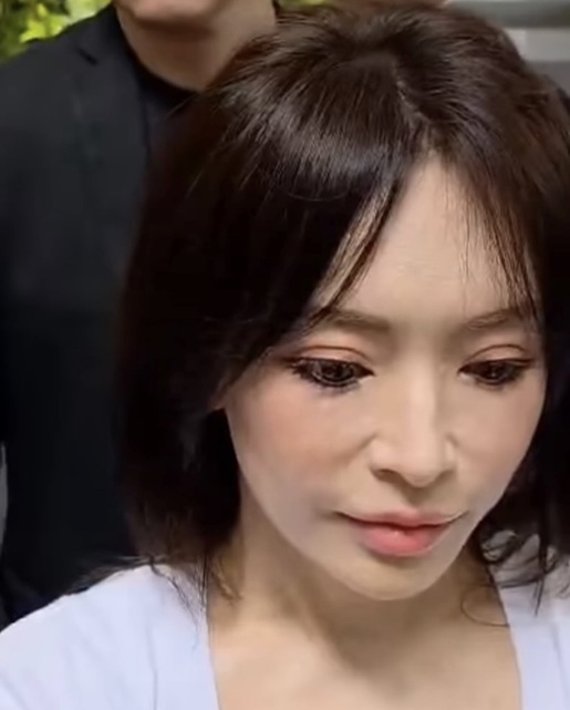 浜崎あゆみ 顔変わった 激変 整形 アップデート 最終形態 香港 ヒアル顏