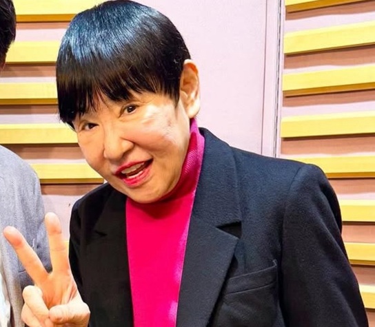 和田アキ子 わだあきこ アッコさん 老化 劣化 整形 ヒアルロン酸 二重整形 整形疑惑 アッコにおまかせ 老害