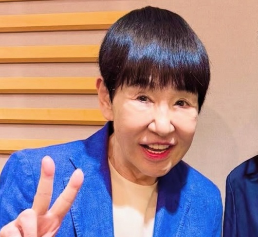 和田アキ子 わだあきこ アッコさん 老化 劣化 整形 ヒアルロン酸 二重整形 整形疑惑 アッコにおまかせ 老害