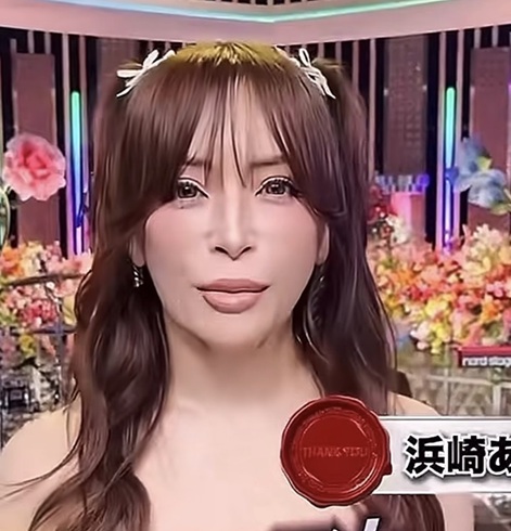 浜崎あゆみ　顔変わった　激変　整形　アップデート　最終形態　香港　ヒアル顏　ダウンタイム　整形