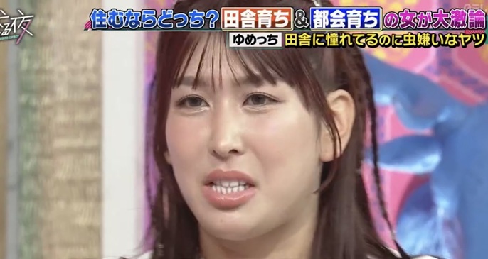 ゆめっち 三時のヒロイン 上田と女が吠える夜 整形 整形公表 美人化 可愛くなった 顔変わった