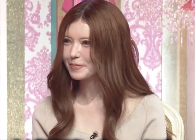 益若つばさ　整形告白　整形疑惑　プチ整形　ヒアル　ヒアルロン酸注入　整形公表　上田と女が吠える夜　つーちゃん　顔変わった　益若つばさ整形