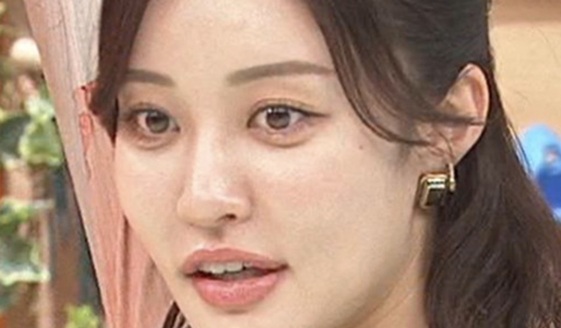 王林　顔変わった　激変　整形　アップデート　注入系　ヒアル顏　上田と女が吠える夜　リンゴ娘 　ホンマでっかTV　涙ぶくろ　涙袋　整形　整形疑惑　注入　唇お化け　涙袋